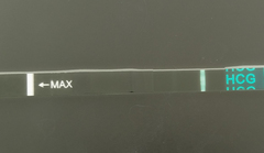 TTC first baby 1 year + thread 2