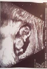 Early Oct babies part 3!