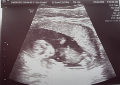 Early Oct babies part 3!