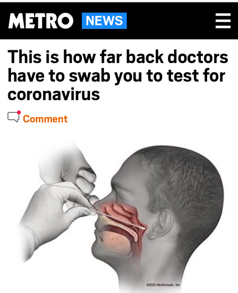 Mild Symptoms