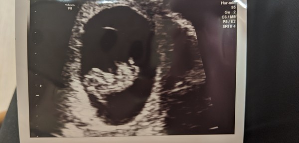 Christmas babies thread 3!