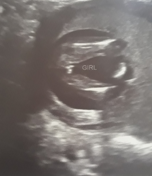 Does this look like a girl potty shot?