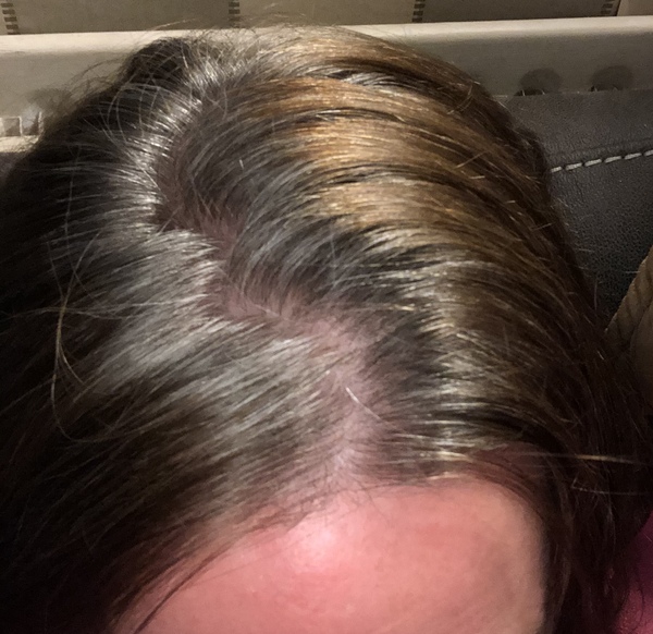 Should I just seize the opportunity to go grey?