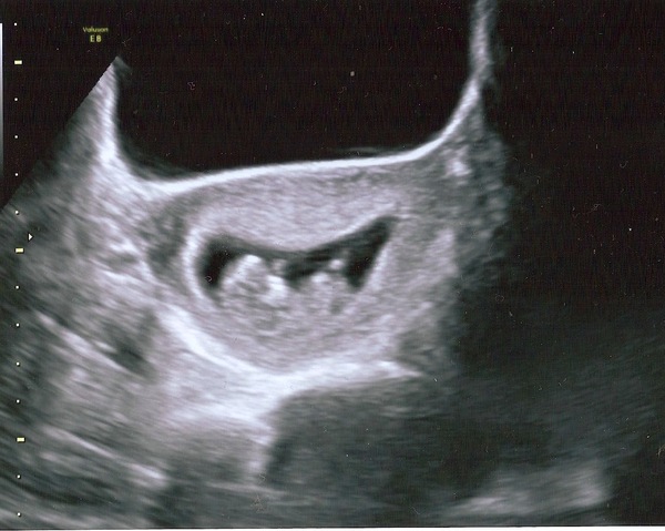 Due end of November Early December 👣