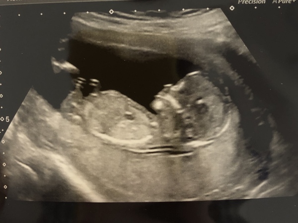 November 2020 Babies - Thread 6!