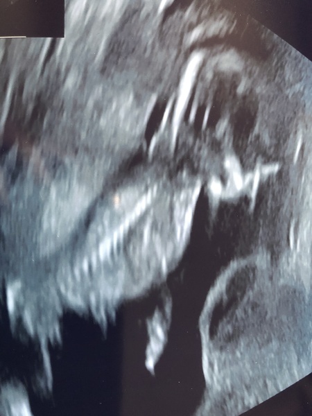 Gender guess nub/skull theory