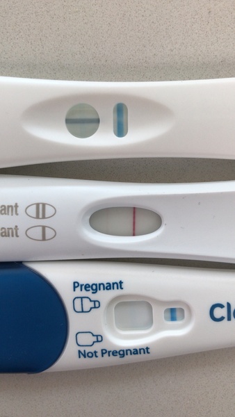 9DPO - are my eyes decieving me...