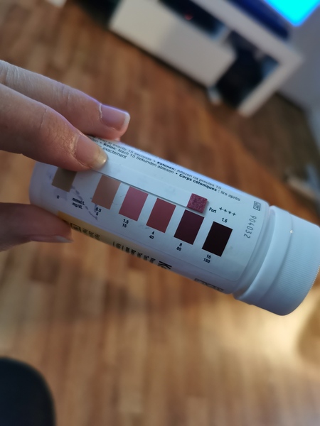 Very high ketone in urine