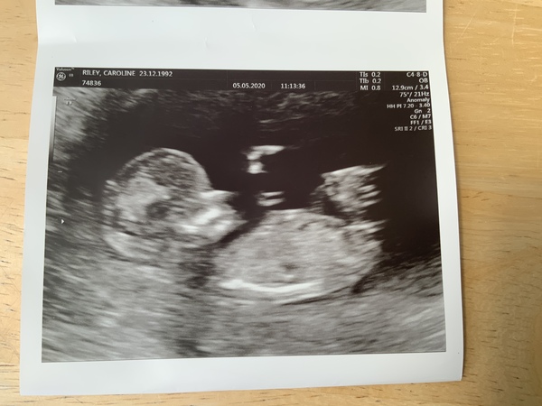 November 2020 Babies - Thread 5