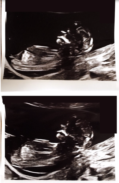 November 2020 Babies - Thread 6!