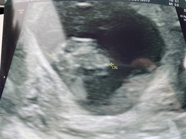 Christmas babies thread 3!