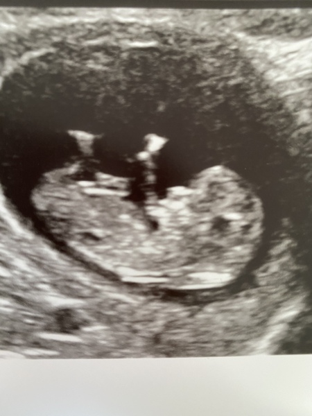12 week scan time ladies 👣 Pregnancies due Late November/December