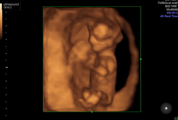 👣 Due Late Nov/Early Dec it's bump time! 👣