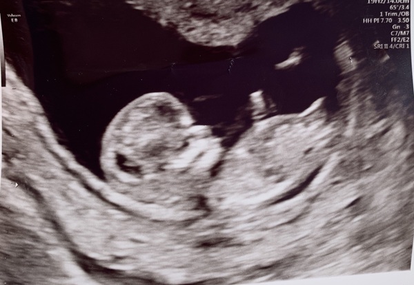 12 week scan time ladies 👣 Pregnancies due Late November/December