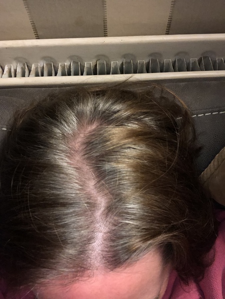 Should I just seize the opportunity to go grey?
