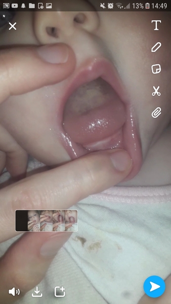 Anyone with any experience with first time teething?