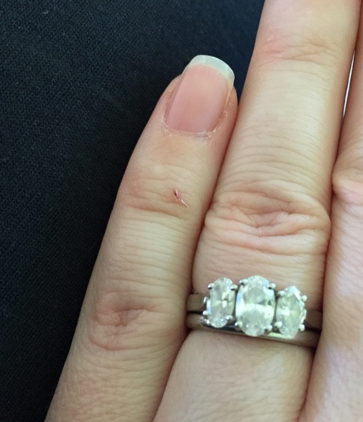 Show your Engagement rings!