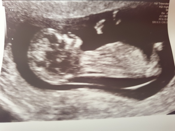 November 2020 Babies - Thread 6!