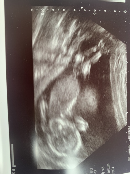 Any gender ideas? 14+5