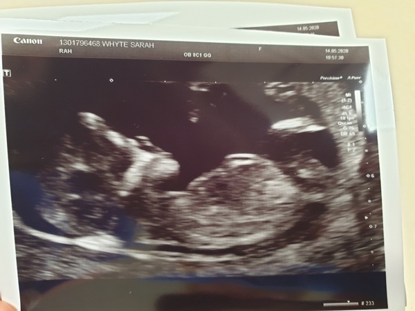 Thread for us classed as mature pregnant ladies