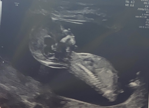 November 2020 Babies - Thread 6!
