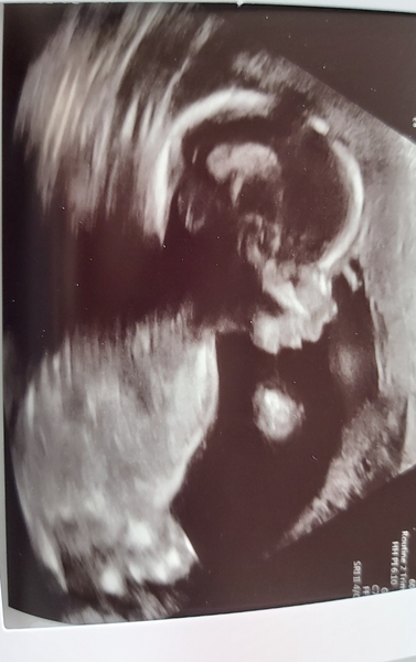 Early Oct babies part 4
