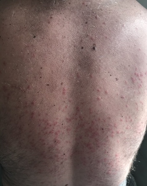 What could be causing this???
