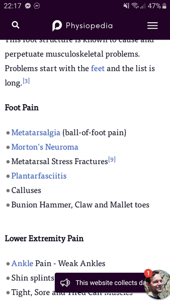 Anyone had plantar fasciitis?