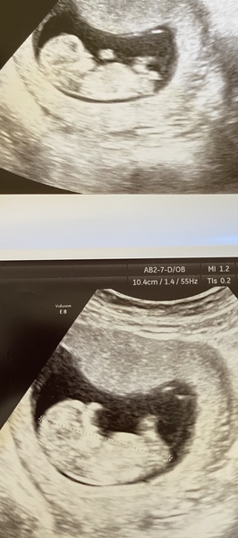 Boy or girl?
