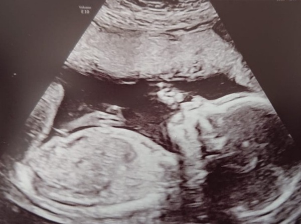 Early Oct babies part 4