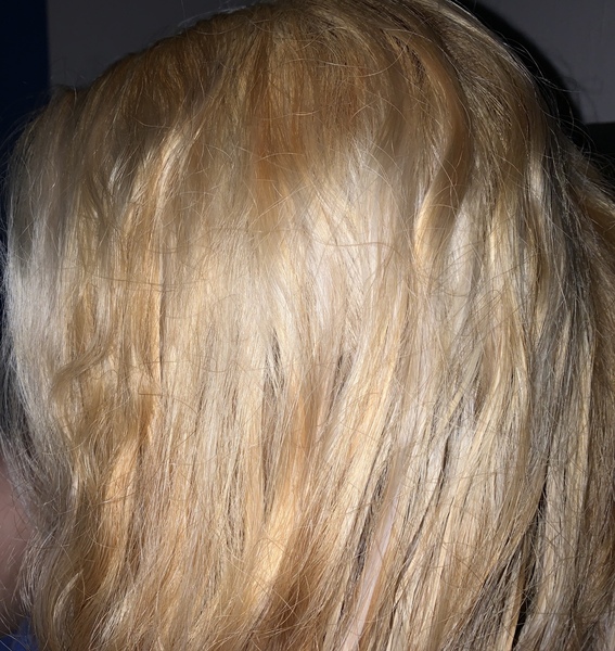 Bleached my hair and need some help!