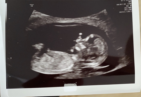 Another one..gender guess?