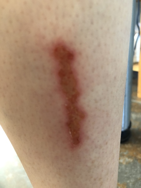 Does this wound look manky? (Pic)