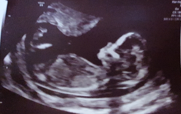 👣 Due Late Nov/Early Dec it's bump time! 👣