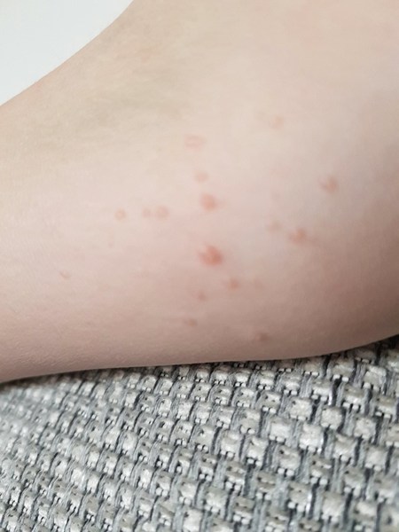 What are these spots? Pic attached