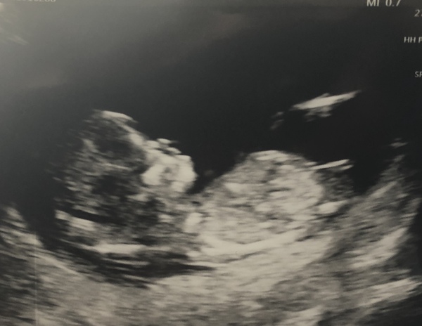 November 2020 Babies - Thread 6!