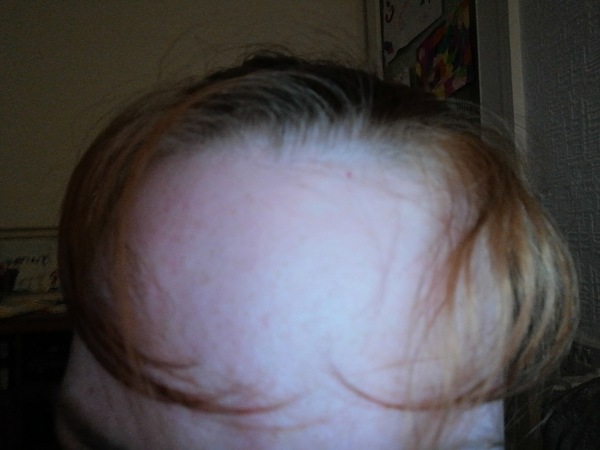 Pleazd help me, my hair is breaking and I look ridiculous!