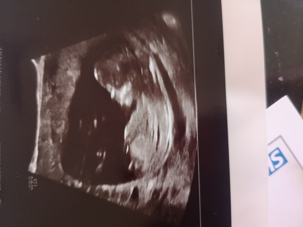 November 2020 Babies - Thread 6!