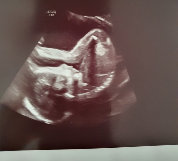 Early Oct babies part 5