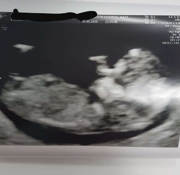 Any guesses on gender?