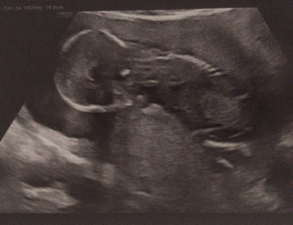 Boy or Girl - nub theorists- enjoy!