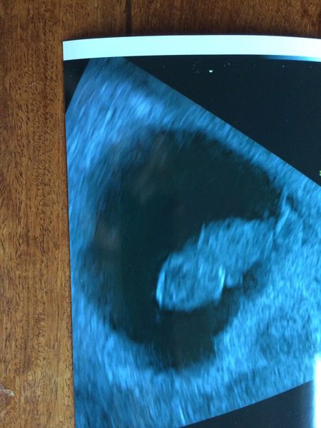 Pregnant after loss and dreaming of rainbows - 3