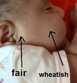 Is my baby skin bi-colored?