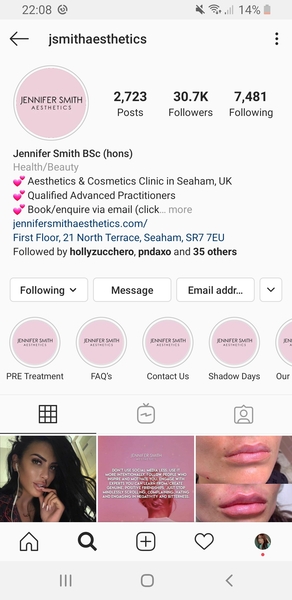 Tear trough fillers - north east?