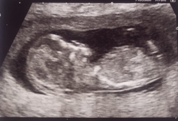 Christmas babies thread 3!