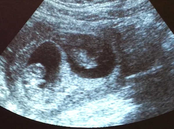 November 2020 Babies - Thread 5