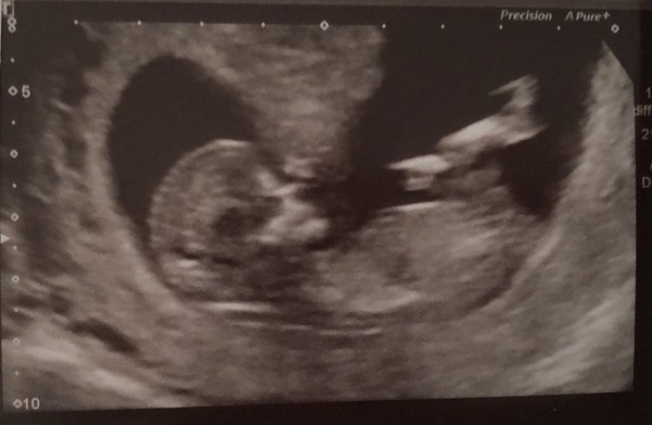 November 2020 Babies - Thread 6!