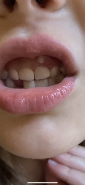 Any dentists around?