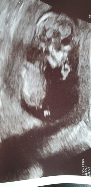 Pregnant after loss and dreaming of rainbows - 3