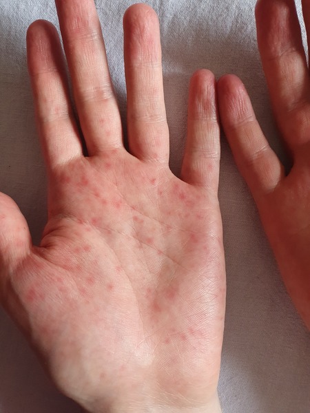 Does anyone know what these spots are please?